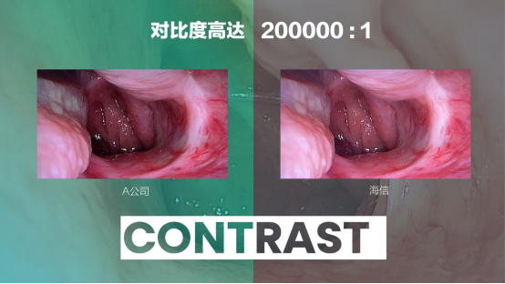 07 海信發(fā)布全球首臺(tái)55吋Mini-LED醫(yī)用內(nèi)窺顯示器365.png