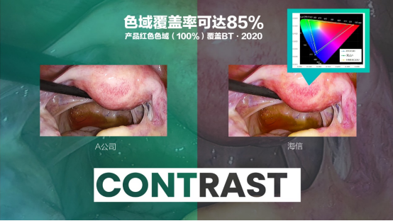 07 海信發(fā)布全球首臺(tái)55吋Mini-LED醫(yī)用內(nèi)窺顯示器631.png